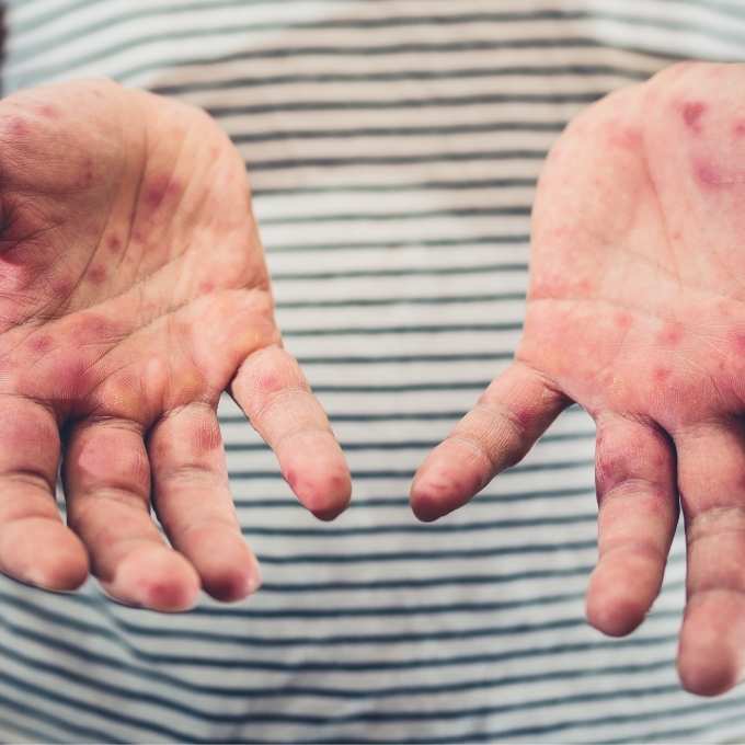 Infectious Disease Cleanup In Nevada Near Me Infectious Disease Cleanup In Nevada Near Me